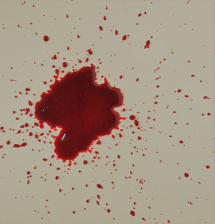 Bloodstain pattern, blood documentation and enhancement, crime scene investigation