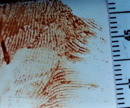 blood impression, crime scene processing, palm print, blood documentation